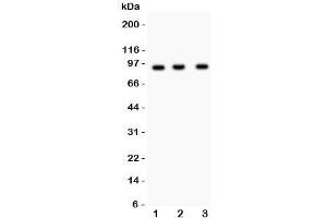 Western blot testing of NEDD9 antibody and Lane 1:  Jurkat;  2: CEM;  3: Raji lysate. (NEDD9 Antikörper)