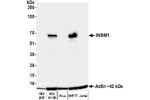 Western Blotting (WB) image for anti-Insulinoma-Associated 1 (INSM1) (AA 75-125) antibody (ABIN7795670)