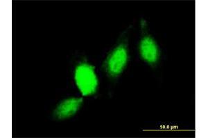 Immunofluorescence of monoclonal antibody to GSTP1 on HeLa cell.