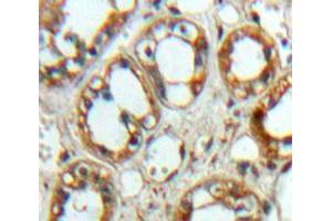 Used in DAB staining on fromalin fixed paraffin-embedded Kidney tissue (SIRPA Antikörper  (AA 116-308))