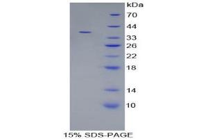 SDS-PAGE (SDS) image for Cardiac Troponin T (cTnT) (AA 1-289) protein (His tag) (ABIN1878865)