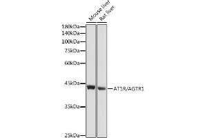 Western blot analysis of extracts of various cell lines, using R/ antibody (ABIN6133546, ABIN6136653, ABIN6136654 and ABIN6218484) at 1:1000 dilution. (Angiotensin II Type-1 Receptor Antikörper  (AA 250-350))