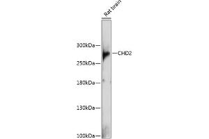 Western blot analysis of extracts of rat brain, using CHD2 antibody (ABIN6133621, ABIN6138503, ABIN6138507 and ABIN6217491) at 1:1000 dilution. (CHD2 Antikörper  (C-Term))