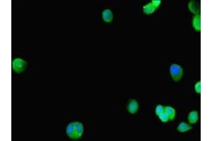Immunofluorescent analysis of HepG2 cells using ABIN7172549 at dilution of 1:100 and Alexa Fluor 488-congugated AffiniPure Goat Anti-Rabbit IgG(H+L) (GATA5 Antikörper  (AA 336-397))