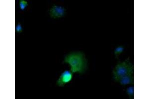 Image no. 2 for anti-Cancer/testis Antigen 1B (CTAG1B) antibody (ABIN1499889) (CTAG1B Antikörper)