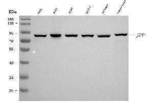 Western blot analysis of gamma Catenin using anti-gamma Catenin antibody (ABIN7602031).