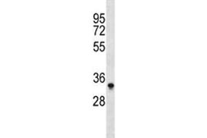 Aurkb antibody western blot analysis in Ramos lysate.