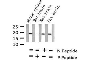 Western blot analysis of Phospho-Stathmin 1 (Ser15) expression in various lysates (Stathmin 1 Antikörper  (pSer15))