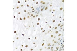 Immunohistochemistry of paraffin-embedded human esophagus using PTBP1 antibody (ABIN5995415) at dilution of 1/100 (40x lens). (PTBP1 Antikörper)