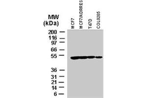 Western blot analysis of BIRC4 in various tumor cell lines recombinant BIRC4 polyclonal antibody  at 1 : 2000.