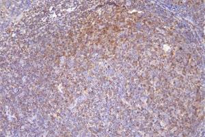 IHC analysis of DCK using anti-DCK antibody (ABIN7600254). (DCK Antikörper  (AA 17-260))