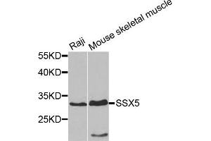 Western blot analysis of extracts of Raji and mouse skeletal muscle cells, using SSX5 antibody.