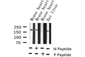 Western blot analysis of Phospho-HER2 (Tyr877) expression in various lysates (ErbB2/Her2 Antikörper  (pTyr877))