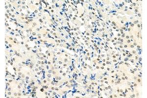 ABIN6265199 and ABIN6273321 at 1/100 staining Rat kidney tissue by IHC-P. (SMYD3 Antikörper  (N-Term))