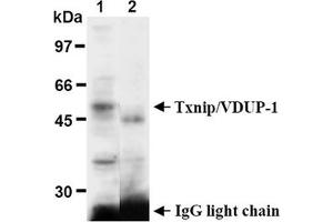 Western Blotting (WB) image for anti-Thioredoxin Interacting Protein (TXNIP) antibody (ABIN567794) (TXNIP Antikörper)