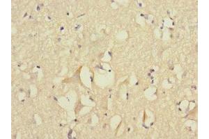 Immunohistochemistry of paraffin-embedded human brain tissue using ABIN7152777 at dilution of 1:100 (FGF12 Antikörper  (AA 1-181))