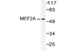 Image no. 1 for anti-Myocyte Enhancer Factor 2A (MEF2A) antibody (ABIN271871) (MEF2A Antikörper)