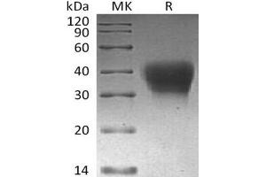 Western Blotting (WB) image for Programmed Cell Death 1 (PDCD1) protein (His tag) (ABIN7320957)