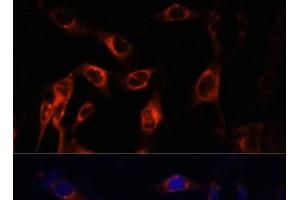 Immunofluorescence analysis of NIH-3T3 cells using TSC1 Polyclonal Antibody at dilution of 1:100 (40x lens). (TSC1 Antikörper)