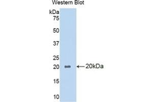 Western blot analysis of the recombinant protein. (PLA1A Antikörper  (AA 309-452))