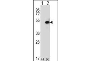 Western blot analysis of SPHK1 (arrow) using rabbit polyclonal SPHK1 Antibody (C-term ) (ABIN652302 and ABIN2837969). (SPHK1 Antikörper  (C-Term))