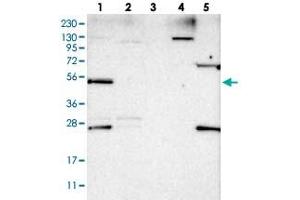 Western blot analysis of Lane 1: RT-4, Lane 2: U-251 MG, Lane 3: Human Plasma, Lane 4: Liver, Lane 5: Tonsil with DDX25 polyclonal antibody . (DDX25 Antikörper)