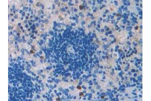 DAB staining on IHC-P; Samples: Rat Spleen Tissue (TGFB2 Antikörper  (AA 331-442))