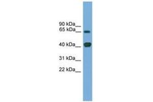 Image no. 1 for anti-LIM Homeobox Transcription Factor 1, alpha (LMX1A) (AA 251-300) antibody (ABIN6744615)