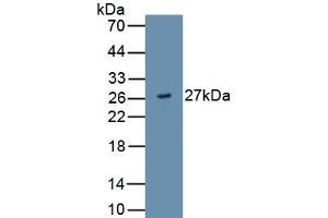 Detection of Recombinant ADAMTS9, Human using Monoclonal Antibody to A Disintegrin And Metalloproteinase With Thrombospondin 9 (ADAMTS9) (ADAMTS9 Antikörper  (AA 1727-1935))