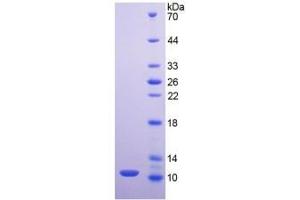 SDS-PAGE of Protein Standard from the Kit  (Highly purified E.