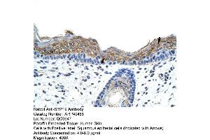 Rabbit Anti-SRAntibody  Paraffin Embedded Tissue: Human Skin Cellular Data: Squamous epithelial cells Antibody Concentration: 4. (SRP19 Antikörper  (Middle Region))