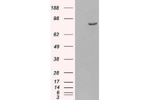 Western Blotting (WB) image for phosphodiesterase 4B, cAMP-Specific (PDE4B) peptide (ABIN368865) (phosphodiesterase 4B, cAMP-Specific (PDE4B) Peptid)