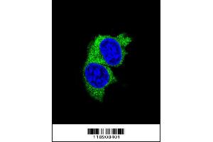 Confocal immunofluorescent analysis of MMP1 Antibody with MDA-MB231 cell followed by Alexa Fluor 488-conjugated goat anti-rabbit lgG (green). (MMP1 Antikörper  (AA 317-347))