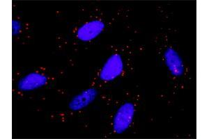 Proximity Ligation Assay (PLA) image for anti-TNF Receptor-Associated Factor 6 (TRAF6) (AA 413-522) antibody (ABIN521096)
