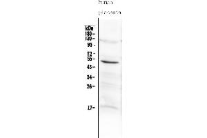 Western blot analysis of MMP10 using anti-MMP10 antibody (ABIN5519038).