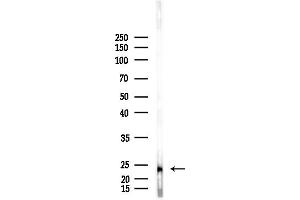 anti-BCL2-Like 2 (BCL2L2) (N-Term) antibody