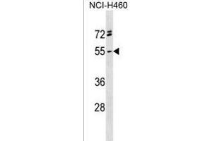 RG Antibody (C-term) (ABIN1537257 and ABIN2838199) western blot analysis in NCI- cell line lysates (35 μg/lane). (RGMA Antikörper  (C-Term))