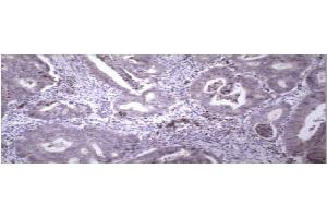 Immunohistochemistry (IHC) image for anti-Matrix Metallopeptidase 9 (Gelatinase B, 92kDa Gelatinase, 92kDa Type IV Collagenase) (MMP9) (C-Term) antibody (ABIN307119)