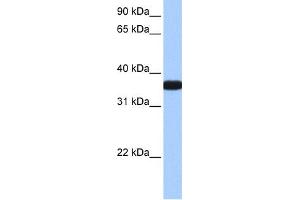 WB Suggested Anti-OCEL1 Antibody Titration:  0. (OCEL1 Antikörper  (C-Term))