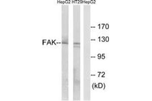 Western blot analysis of extracts from HepG2/HT-29 cells, using FAK (Ab-397) Antibody. (FAK Antikörper  (AA 363-412))
