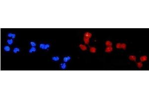 IF analysis of DDB2 using anti-DDB2 antibody (ABIN3043488). (DDB2 Antikörper  (AA 1-115))