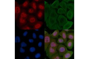 ABIN6255654 and ABIN6267462 staining Hela cells by IF/ICC.