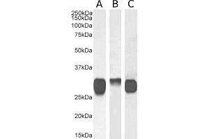 Western Blot using anti-HLA class II histocompatibility antigen DR antibody F3. (Rekombinanter HLA Class II Antikörper)