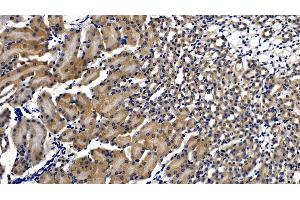 Detection of MyD88 in Mouse Kidney Tissue using Polyclonal Antibody to Myeloid Differentiation Factor 88 (MyD88) (MYD88 Antikörper  (AA 32-265))