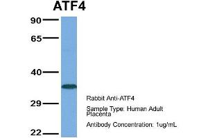 Host:  Rabbit  Target Name:  ATF4  Sample Type:  Human Adult Placenta  Antibody Dilution:  1. (ATF4 Antikörper  (Middle Region))