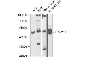 Western blot analysis of extracts of various cell lines, using SMYD2 antibody (ABIN6130910, ABIN6148167, ABIN6148168 and ABIN6222133) at 1:1000 dilution. (SMYD2A Antikörper  (AA 1-270))
