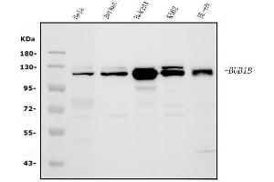 Western blot analysis of BubR1/BUB1B using anti-BubR1/BUB1B antibody (ABIN7600962). (BUB1B Antikörper  (AA 26-448))