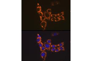 Immunofluorescence analysis of NIH-3T3 cells using H2-Ab1 Rabbit pAb (ABIN7267665) at dilution of 1:100 (40x lens). (H2-AB1 Antikörper)