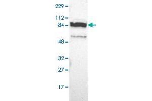 Western blot analysis of Human cell line RT-4 with PPFIBP2 polyclonal antibody  at 1:100-1:250 dilution. (PPFIBP2 Antikörper)