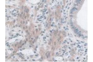 IHC-P analysis of Mouse Uterus Tissue, with DAB staining. (GLP1R Antikörper  (AA 25-145))